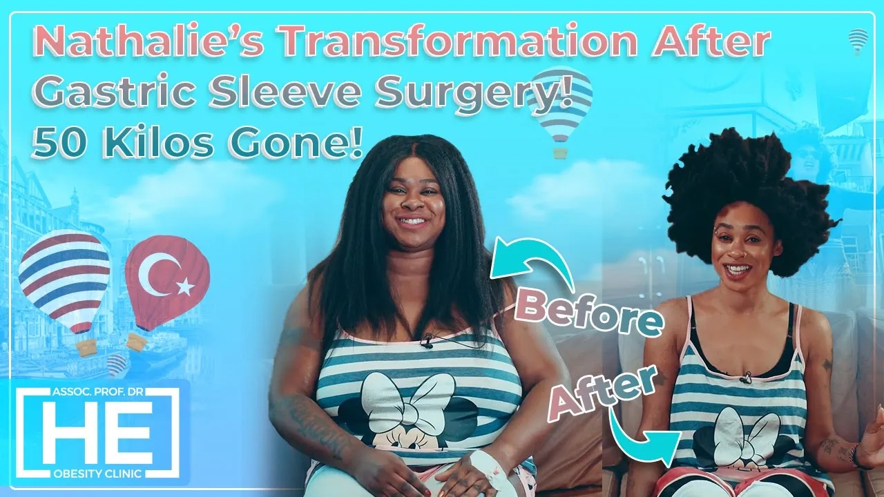 Nathalies Gastric Sleeve Before and After Story  50 Kilos Gone!
